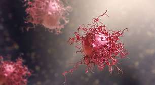 Neoplasia: entenda a doença que afastou o narrador Luis Roberto da Copa e seus possíveis impactos na saúde