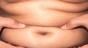 Do açúcar à noite aos ultraprocessados: os vilões ocultos que travam seu metabolismo