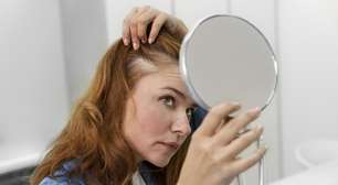Queda de cabelo pode estar relacionada a falta de vitaminas. Especialista explica quando se preocupar