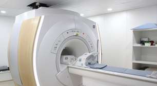 Uso de IA avança na medicina diagnóstica do DF