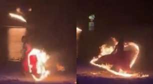 URGENTE! Incêndio deixa dançarina com o corpo em chamas; veja como ela está