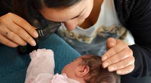 Como identificar problemas de visão em bebês: sinais de alerta e a importância do 'Teste do Olhinho'