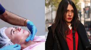 O segredo de Alessandra Negrini: atriz revela técnica com células-tronco para pele perfeita