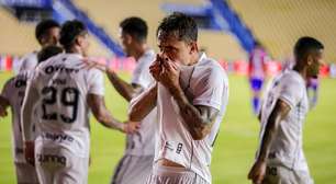 Zanocelo e +3: Ceará deve seguir com desfalques para quarta rodada da Série B