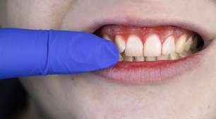 O 'escudo invisível' da boca: como proteínas vegetais podem substituir a saliva natural