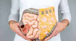 Como o intestino influencia o humor e a energia: entenda a conexão entre microbioma, cérebro e bem-estar mental