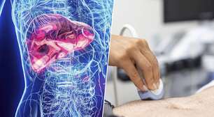 Epidemia "silenciosa" do fígado: temos um problema que escapa exames e que a ciência tenta deter