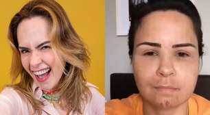 Gente? Ana Paula Renault surge irreconhecível e inchada em vídeo antigo após procedimento estético; antes e depois viraliza: 'Pelo visto funcionou'