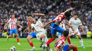 Mbappé leva pontos no rosto e vira dúvida para treino do Real Madrid