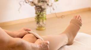 Veja as principais causas das varizes e quando procurar um especialista