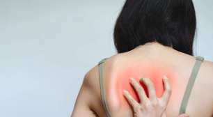 Coceira nas costas que não é alergia: entenda a Notalgia Parestésica e sua origem nos nervos da coluna