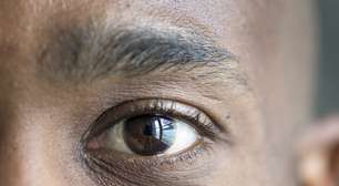 Abril Marrom: 80% dos casos de cegueira poderiam ser evitados