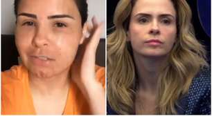 BBB 26: Antes e depois de Ana Paula Renault surpreende após vídeo antigo viralizar