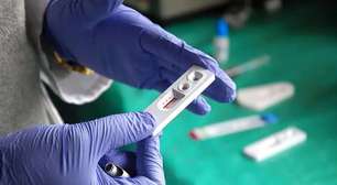 Esperança: homem tem "cura funcional" do HIV após transplante com mutação genética rara