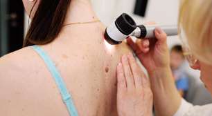 10 razões para visitar o dermatologista com mais frequência