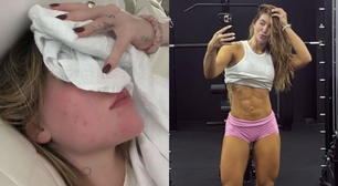 Treinar pode causar crises de enxaqueca? Médico tira dúvidas após Virgínia revelar mudanças em exercícios devido ao diagnóstico: 'Priorizar regularidade em vez de intensidade'