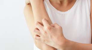 Coceira na menopausa? Entenda por que sua pele muda e como acabar com a dor