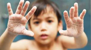 Por que os dedos enrugam na água? A surpreendente resposta ativa do cérebro e a evolução por trás disso