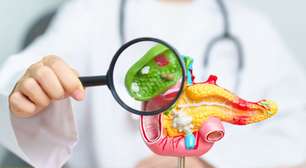 Pedra na vesícula: conheça os sintomas da doença