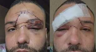 Designer sofre 35 pontos no rosto após sofrer ataque homofóbico em bar no Rio