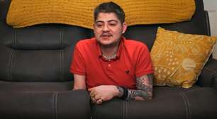 Homem relata como é a vida após ter metade do corpo amputado