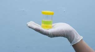 Alerta nos rins: Saiba por que a urina com espuma não deve ser ignorada