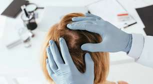 Caspa explicada: o que é, por que surge e como tratar com shampoos, hábitos e cuidados baseados em evidências médicas