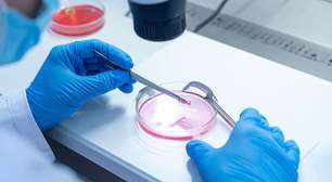 Congelar óvulos garante a maternidade no futuro? Especialista faz alerta importante