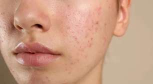 Especialista explica os efeitos do chocolate no organismo