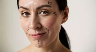 Mulheres 50+ e a nova relação com o rejuvenescimento