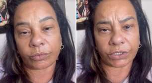 Fora do BBB26, Solange Couto revela problema de saúde: 'Estava no hospital'
