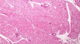 O "motor oculto" do corpo: a ciência por trás da gordura marrom ativada e sua relação com o gasto calórico