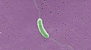 Bactéria 'comedora de carne' encontrada próxima a Nova York pode matar 20% dos infectados em 48 horas, dizem pesquisadores