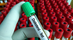 Pesquisa consegue inibir produção de gordura e colesterol