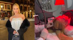 Virginia volta a ter alopecia e cita estresse como fator; entenda a relação