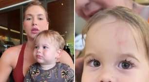 ACIDENTE! Filho de Virginia volta da escola com hematoma na testa