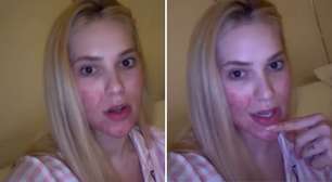 É GRAVE? Virginia Fonseca revela recidiva de doença difícil: 'Vou tratar'