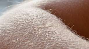 Por que sentimos arrepio? A ciência da piloereção, o papel do sistema nervoso e o fenômeno do "frisson" ligado às emoções humanas