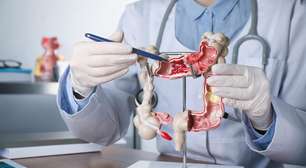 Câncer de intestino está entre os que mais matam: veja como prevenir