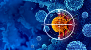 Poliaminas podem acelerar o crescimento de tumores cancerosos