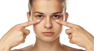 Nem tudo é sono: o que suas olheiras realmente revelam sobre genética, circulação e estrutura do seu rosto