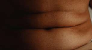 Barriga dura ou mole? Descubra qual delas sinaliza um risco real para o seu coração