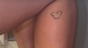 Lore Improta revela manchas brancas na pele: É normal durante a gestação?