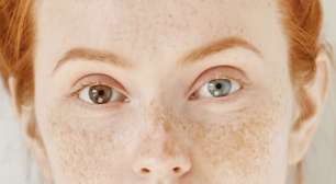 Entenda por que algumas pessoas têm olhos de cores diferentes