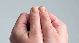 Unhas fracas, quebradiças e com manchas? O que isso revela sobre sua nutrição e quais deficiências podem estar por trás
