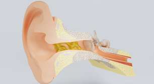 O "vilão" que protege você: entenda a função da cera de ouvido e por que ela não deve ser removida com cotonete