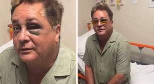 SUSTO! Leonardo machuca o rosto durante pescaria no Pantanal e vai parar no hospital