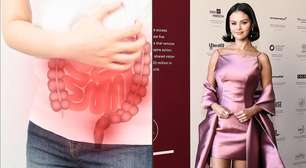 O que é SIBO? Entenda a condição intestinal que afeta Selena Gomez