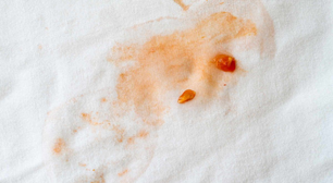 Mancha de molho no guardanapo? Veja como remover sem esforço