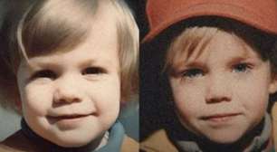 Patrick Christenson: o bebê que nasceu com as cicatrizes do irmão falecido